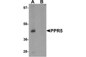 Western blot analysis of PRR5 in SK-N-SH cell lysate with PRR5 antibody at 1 μg/ml in (A) the absence and (B) the presence of blocking peptide (PRR5 抗体  (C-Term))