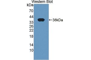 Western blot analysis of the recombinant protein. (LASP1 抗体  (AA 1-261))