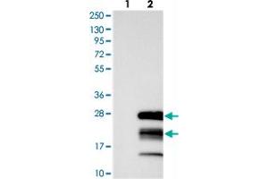 Western blot analysis of Lane 1: Negative control (vector only transfected HEK293T lysate), Lane 2: Over-expression Lysate (Co-expressed with a C-terminal myc-DDK tag (~3. (GTSF1 抗体)