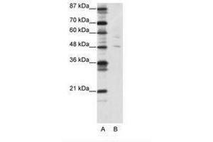 Image no. 1 for anti-Pleiomorphic Adenoma Gene-Like 1 (PLAGL1) (N-Term) antibody (ABIN202463)