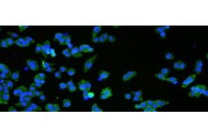 Immunofluorescence analysIs ofNCCIT cell using VMA21 Polyclonal Antibody at dilution of 1:50 (VMA21 抗体)