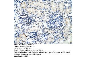 Rabbit Anti-DDX17 Antibody  Paraffin Embedded Tissue: Human Kidney Cellular Data: Epithelial cells of renal tubule Antibody Concentration: 4. (DDX17 抗体  (N-Term))
