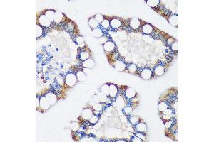 Immunohistochemistry of paraffin-embedded Human colon using TRIM62 Rabbit pAb (ABIN7270996) at dilution of 1:100 (40x lens). (TRIM62 抗体  (AA 120-280))
