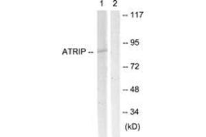 Western blot analysis of extracts from NIH-3T3 cells, using ATRIP (Ab-68/72) Antibody. (ATRIP 抗体  (AA 34-83))