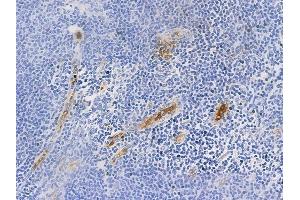 ABIN6256749 and ABIN6267522 at 1/100 staining human normal tonsil tissue by IHC-P.