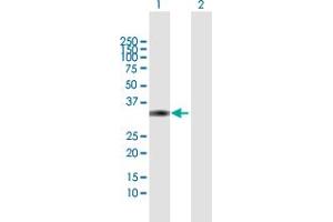 Western Blot analysis of DKK4 expression in transfected 293T cell line by DKK4 MaxPab polyclonal antibody. (DKK4 抗体  (AA 1-224))
