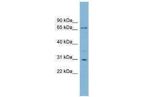 TBCCD1 antibody used at 1 ug/ml to detect target protein. (TBCCD1 抗体  (N-Term))