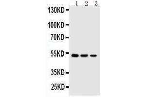 Anti-Kallistatin antibody, Western blotting Lane 1: SMMC Cell Lysate Lane 2: COLO320 Cell Lysate Lane 3: JURKAT Cell Lysate (SERPINA4 抗体  (C-Term))