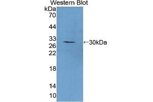 Detection of Recombinant PTTG1, Mouse using Polyclonal Antibody to Pituitary Tumor Transforming 1 (PTTG1) (PTTG1 抗体  (AA 2-199))