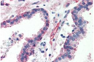 Human Prostate (formalin-fixed, paraffin-embedded) stained with ITGB1 antibody ABIN364255 at 10 ug/ml followed by biotinylated anti-mouse IgG secondary antibody ABIN481714, alkaline phosphatase-streptavidin and chromogen. (ITGB1 抗体)