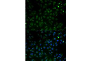 Immunofluorescence analysis of HeLa cells using VDAC1 antibody. (VDAC1 抗体)