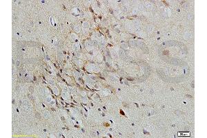 Formalin-fixed and paraffin-embedded rat brain labeled with Rabbit Anti-Versican Polyclonal Antibody, Unconjugated (ABIN741660) 1:200 followed by conjugation to the secondary antibody and DAB staining (Versican 抗体  (AA 3301-3396))