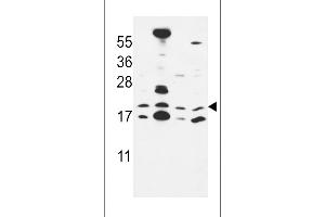 Western blot analysis in MCF-7,NCI-H460,HepG2,Hela cell line lysates (35ug/lane). (CNPY2/MSAP 抗体  (C-Term))