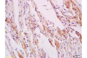Formalin-fixed and paraffin embedded smooth muscle of rat stomach labeled with Anti-Phospho-HSP27(Ser78) Polyclonal Antibody, Unconjugated (ABIN685303) at 1:200 followed by conjugation to the secondary antibody and DAB staining