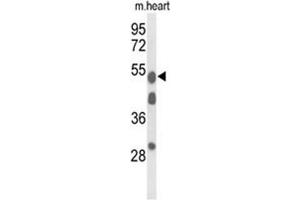 Western blot analysis of A1BG Antibody (Center) in mouse heart tissue lysates (35 µg/lane). (A1BG 抗体  (Middle Region))