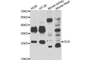 Western blot analysis of extracts of various cell lines, using GCA antibody (ABIN5974261) at 1/1000 dilution. (Grancalcin 抗体)