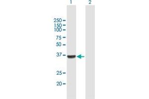 Western Blot analysis of WISP1 expression in transfected 293T cell line by WISP1 MaxPab polyclonal antibody. (WISP1 抗体  (AA 1-280))