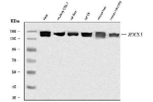 Western blot analysis of ROCK1 using anti-ROCK1 antibody (ABIN7602158).