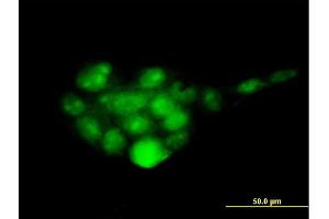 Immunofluorescence of monoclonal antibody to PSMD14 on A-431 cell. (PSMD14 抗体  (AA 1-95))