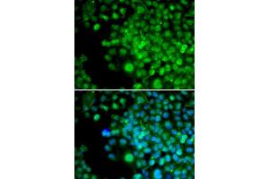 Immunofluorescence analysis of HeLa cells using FHL1 antibody (ABIN5973173).