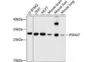 PSMA7 抗体