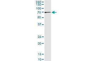 Immunoprecipitation (IP) image for anti-Membrane Protein, Palmitoylated 2 (MAGUK P55 Subfamily Member 2) (MPP2) (AA 1-552) antibody (ABIN518005)