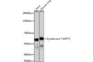 Western blot analysis of extracts of various cell lines, using Cytokeratin 7 (KRT7) (KRT7) Rabbit mAb  at 1:1000 dilution. (Cytokeratin 7 抗体)