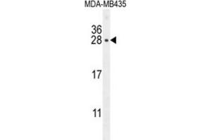 Western Blotting (WB) image for anti-Chorionic Somatomammotropin Hormone 1 (Placental Lactogen) (CSH1) antibody (ABIN2995923)