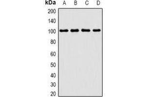 Western blot analysis of PIMT expression in Jurkat (A), MCF7 (B), mouse thymus (C), mouse testis (D) whole cell lysates. (PCMT1 抗体)