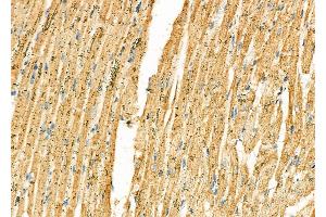 ABIN6265015 and ABIN6277239 at 1/100 staining Rat heart tissue by IHC-P. (SERPINH1 抗体  (Internal Region))