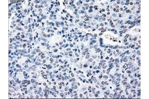 Image no. 2 for anti-Crystallin, alpha B (CRYAB) antibody (ABIN1497647) (CRYAB 抗体)
