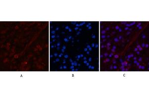 Immunofluorescence analysis of human appendix tissue. (Peroxiredoxin 1 抗体)