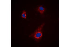 Immunofluorescent analysis of ATG4C staining in K562 cells. (ATG4C 抗体  (N-Term))