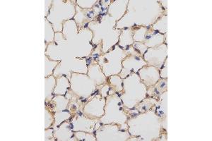 (ABIN657832 and ABIN2846797) staining Mouse Csf1r in mouse lung tissue sections by Immunohistochemistry (IHC-P - paraformaldehyde-fixed, paraffin-embedded sections). (CSF1R 抗体  (C-Term))