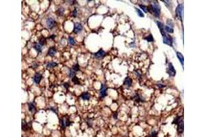 Staining of PLIN5 on mouse fat using PLIN5 polyclonal antibody . (PLIN5 抗体  (AA 300-400))