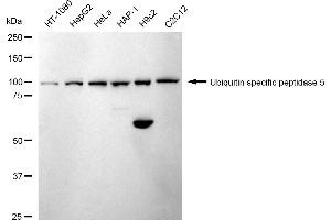 Western blotting analysis using Ubiquitin specific peptidase 5 antibody (ABIN7800737). (Recombinant USP5 抗体)