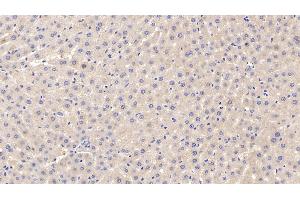 Detection of APOF in Rat Liver Tissue using Polyclonal Antibody to Apolipoprotein F (APOF)