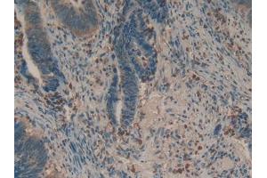 Used in DAB staining on fromalin fixed paraffin- embedded liver tissue (Biglycan 抗体  (AA 243-369))