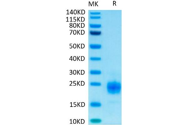 TIGIT Protein (His-Avi Tag,Biotin)