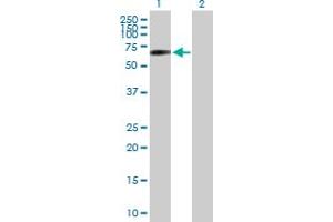 Western Blot analysis of SNPH expression in transfected 293T cell line by SNPH MaxPab polyclonal antibody. (Syntaphilin 抗体  (AA 1-494))