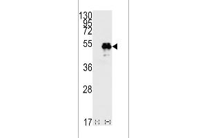 Western blot analysis of TP53(arrow) using rabbit polyclonal p53 Antibdoy (T55) (ABIN390200 and ABIN2840687). (p53 抗体  (AA 33-62))