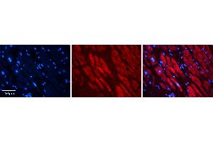 Rabbit Anti-RAD23B Antibody Catalog Number: ARP56505_P050 Formalin Fixed Paraffin Embedded Tissue: Human heart Tissue Observed Staining: Cytoplasmic Primary Antibody Concentration: 1:100 Other Working Concentrations: N/A Secondary Antibody: Donkey anti-Rabbit-Cy3 Secondary Antibody Concentration: 1:200 Magnification: 20X Exposure Time: 0. (RAD23B 抗体  (Middle Region))