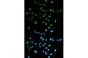 Immunofluorescence analysis of A549 cells using PAX2 antibody (ABIN1874046). (PAX2A 抗体)