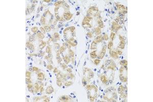 Immunohistochemistry of paraffin-embedded human stomach using MIP antibody (ABIN3016917, ABIN3016918, ABIN3016919 and ABIN6219879) at dilution of 1:100 (40x lens). (Mip (AA 50-150) 抗体)
