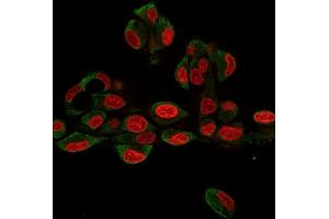 Immunofluorescence Analysis of HePG2 cells labeling GRP94 with GRP94 Rat Monoclonal Antibody (9G10. (GRP94 抗体)