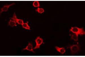 ABIN6268688 staining HeLa by IF/ICC. (IL-4 抗体  (Internal Region))