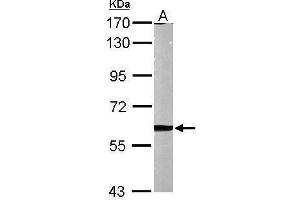 WB Image Sample (50 ug of whole cell lysate) A: Mouse brain 7. (MMP2 抗体)