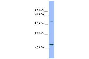 WB Suggested Anti-XYLT2 Antibody Titration:  0. (XYLT2 抗体  (Middle Region))