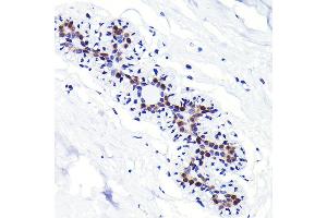 Immunohistochemistry of paraffin-embedded human breast using CDKN1B/p27KIP1 Rabbit mAb (ABIN7266602) at dilution of 1:100 (40x lens). (CDKN1B 抗体)