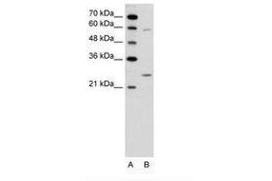 Image no. 1 for anti-Guanidinoacetate N-Methyltransferase (GAMT) (N-Term) antibody (ABIN6736619) (GAMT 抗体  (N-Term))